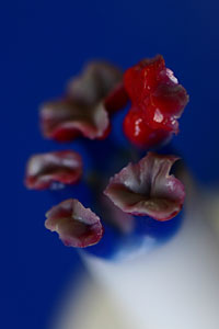 Wachsmodellation für Inlays